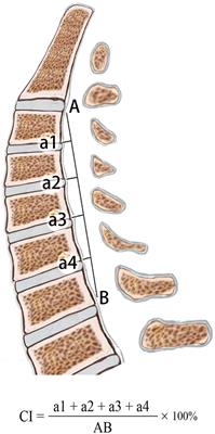 Cervical alignment and clinical outcome of anterior decompression with fusion vs. posterior decompression with fixation in kyphotic cervical spondylotic myelopathy